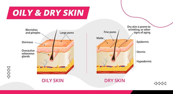 Illustration of different skin types so you know what is The Best Facials For Your Skin Type